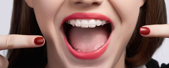ortodoncia-estetica-zafiro