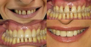 Dentista en arteixo ortodoncia