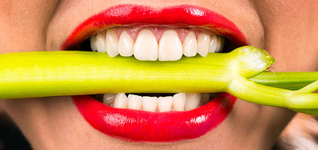 Blanqueamiento dental, la operación bikini de la odontología
